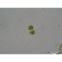 Cosmarium moniliforme