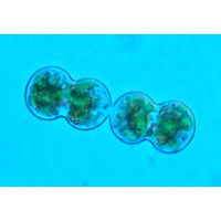 Cosmarium moniliforme