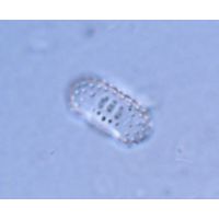 Cosmarium notatum