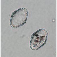 Cosmarium notatum