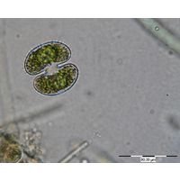 Cosmarium ocellatum
