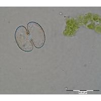 Cosmarium ocellatum