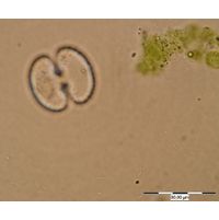 Cosmarium ocellatum