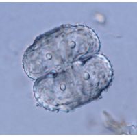 Cosmarium ornatum