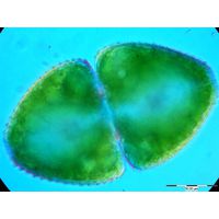 Cosmarium ovale