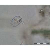 Cosmarium paragranatoides