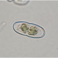 Cosmarium parvulum
