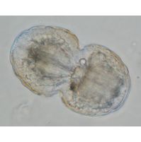 Cosmarium pericymatium