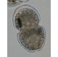 Cosmarium pericymatium