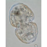 Cosmarium pericymatium