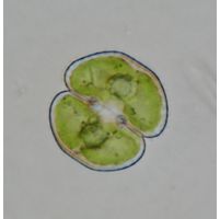 Cosmarium phaseolus
