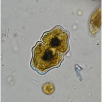 Cosmarium pokornyanum