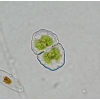 Cosmarium