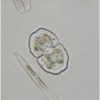 Cosmarium
