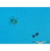 Cosmarium prominulum