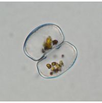 Cosmarium protuberans