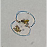 Cosmarium protuberans