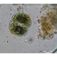 Cosmarium pseudonitidulum