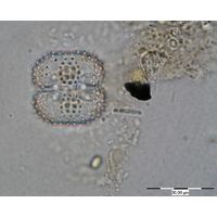Cosmarium pseudoornatum