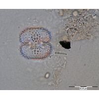 Cosmarium pseudoornatum
