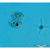 Cosmarium pseudoprotuberans
