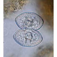 Cosmarium pseudoprotuberans