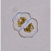Cosmarium pseudoretusum