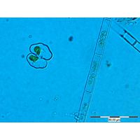 Cosmarium pseudowembaerense