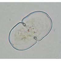 Cosmarium quadratum