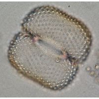 Cosmarium quadrum