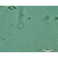 Cosmarium regnelii
