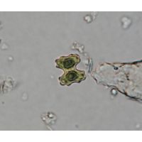 Cosmarium regnesii