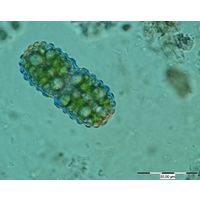 Cosmarium simplicius