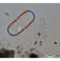Cosmarium simplicius