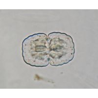 Cosmarium