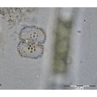 Cosmarium