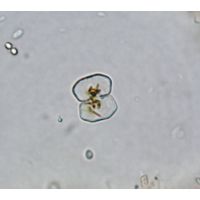 Cosmarium