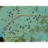 Cosmarium