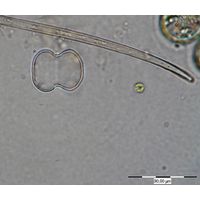 Cosmarium