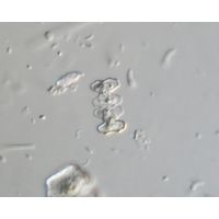 Cosmarium