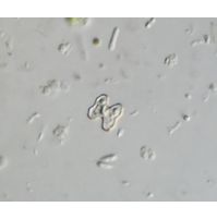 Cosmarium