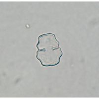 Cosmarium sphyrelatum