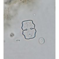 Cosmarium sphyrelatum