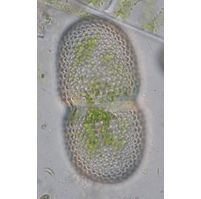 Cosmarium striolatum