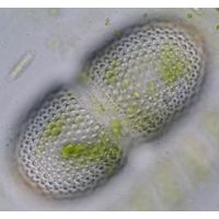 Cosmarium striolatum