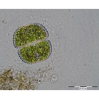 Cosmarium subbroomei