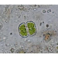Cosmarium subcostatum