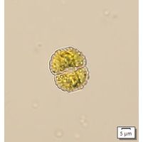 Cosmarium