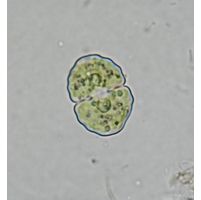 Cosmarium subgranatum