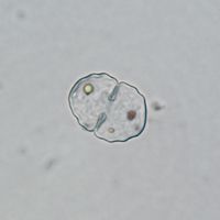 Cosmarium subgranatum
